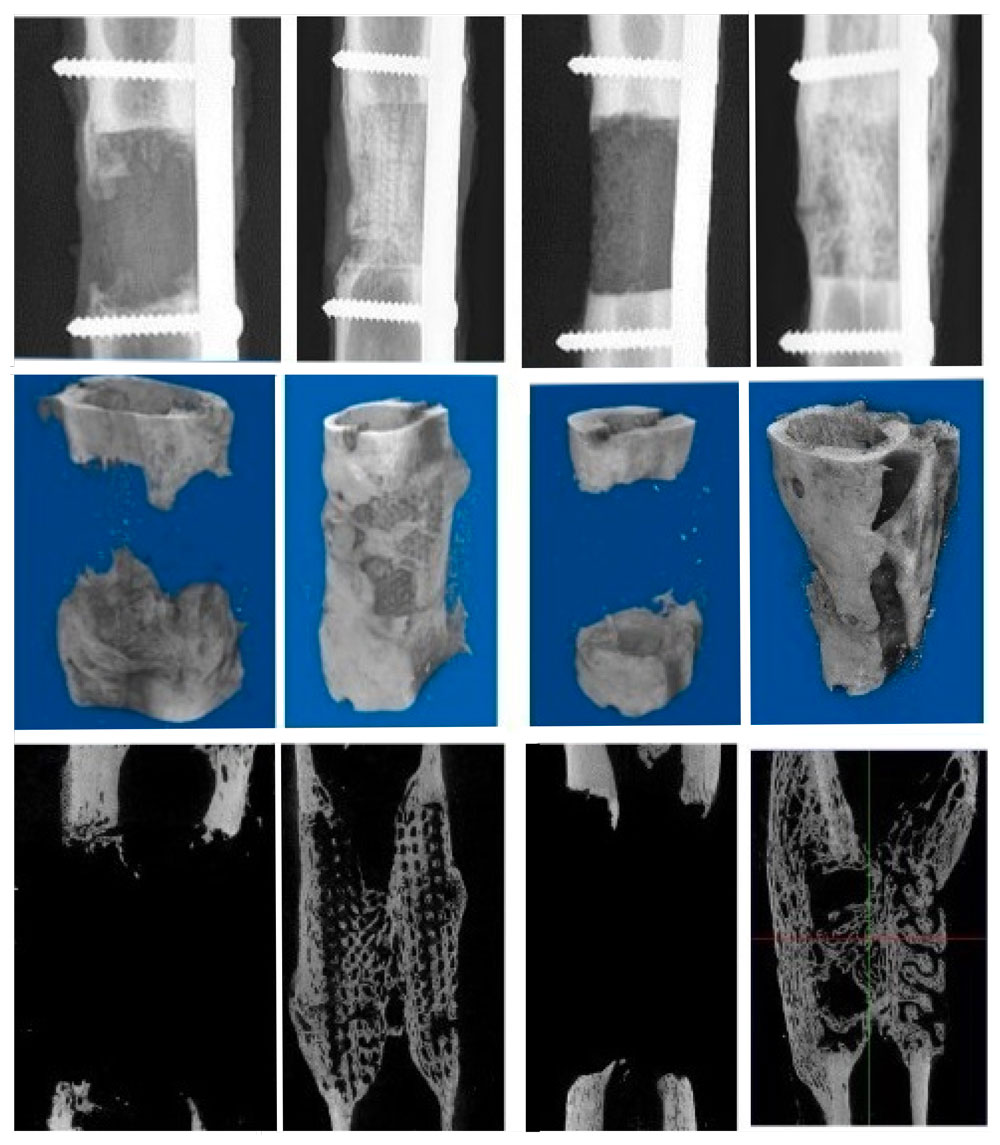 Images radiographiques et images scanner 3D - crédit Garot et al./Adv Healthcare materials