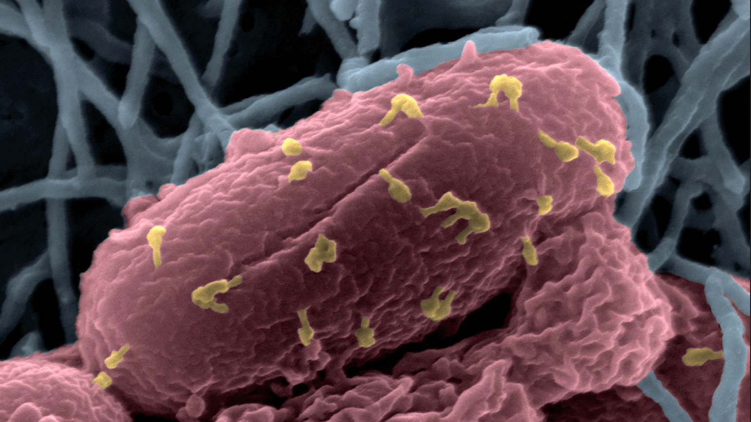 Image en microscopie électronique à balayage colorisée d'une bactérie attaquée par des bactériophages