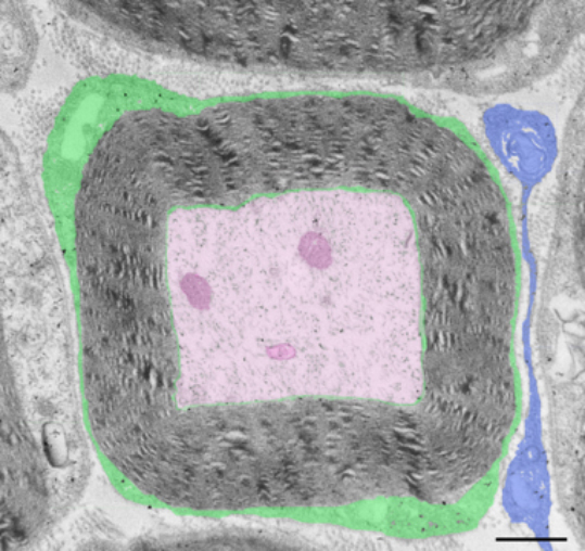 © INSERM, Nicolas Tricaud, Institut des Neurosciences de Montpellier