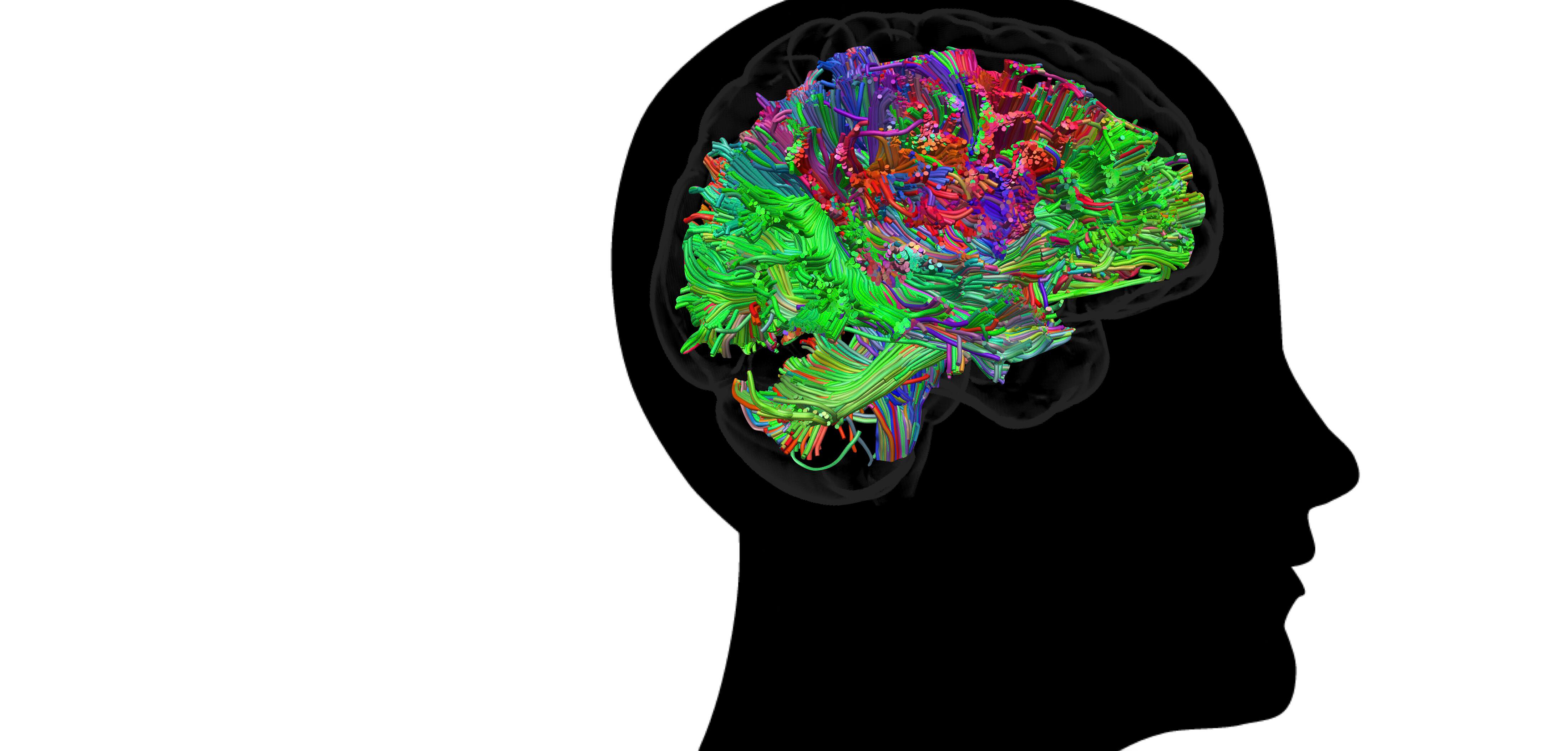 Buy Cerveau soit boite mystère: Un état de Conscient à Inconscient