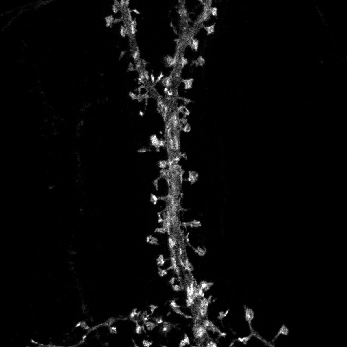 Épines dendritiques