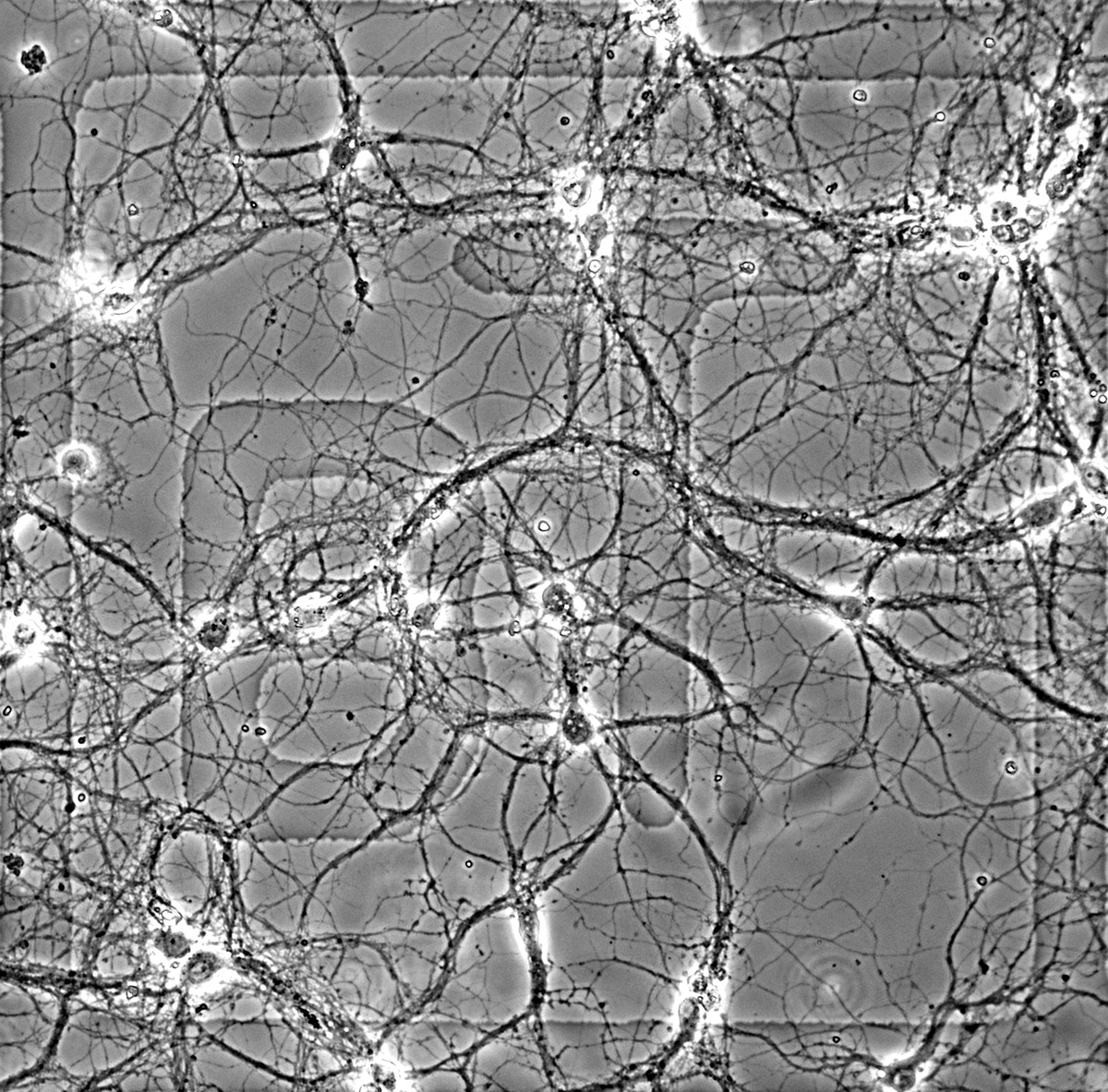 Localisation des protéines via étapes d'immunomarquage et observation microscopique