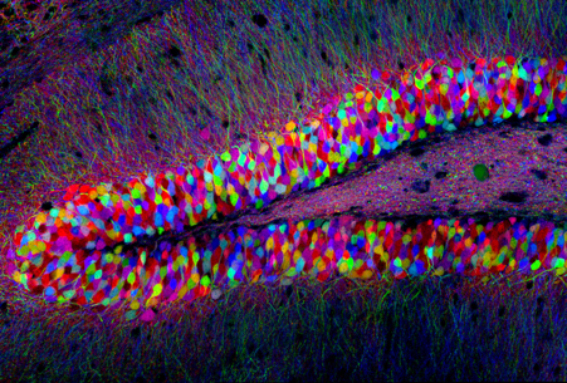 © Image by Tamily Weissman. The Brainbow mouse was produced by Jean Livet, Joshua Sanes and Jeff Lichtman. 