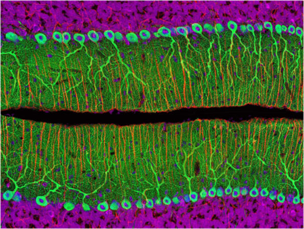 © Thomas Deerinck, National Center for Microscopy and Imaging Research