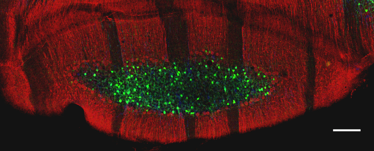 Deux clichés confocaux juxtaposés montrant neurones rouges, verts et bleus sur fond sombre. © Jean-Luc Dupont / CNRS Images
