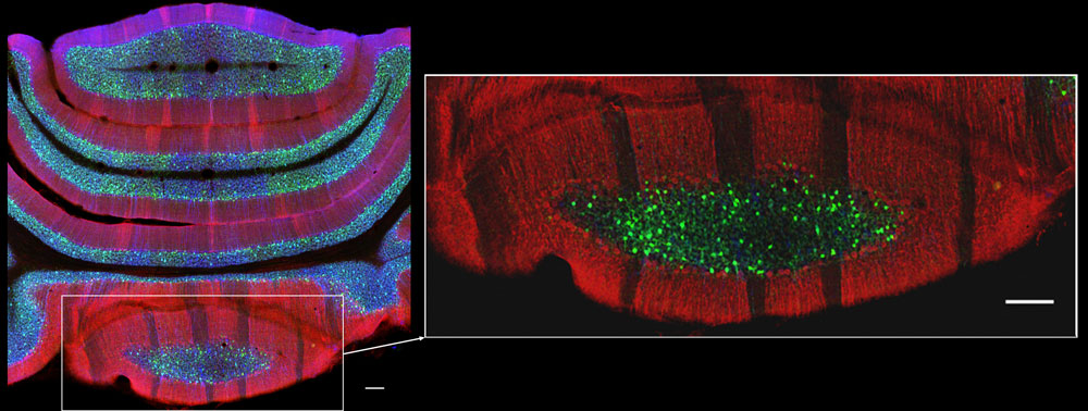 Cartographie cellulaire du cortex cérébelleux de souris © Jean-Luc Dupont / INCI / CNRS Images