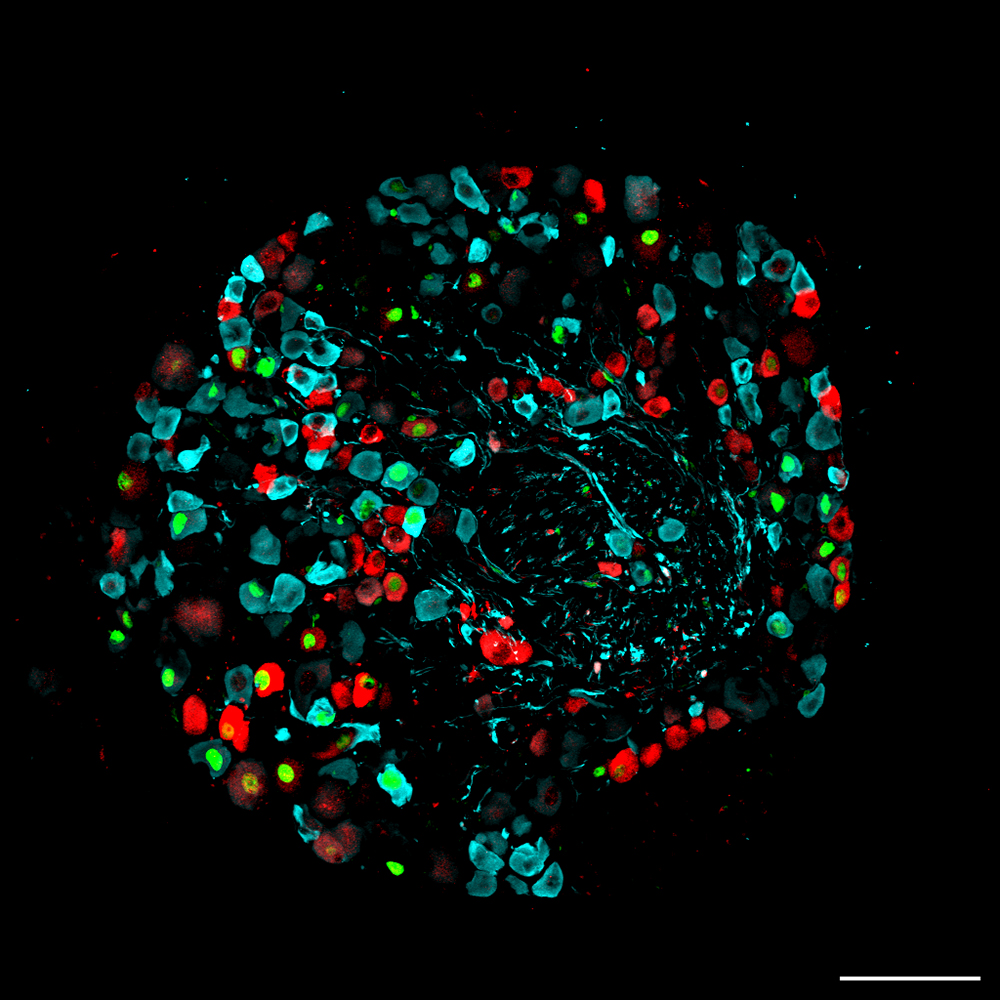  100 µm.