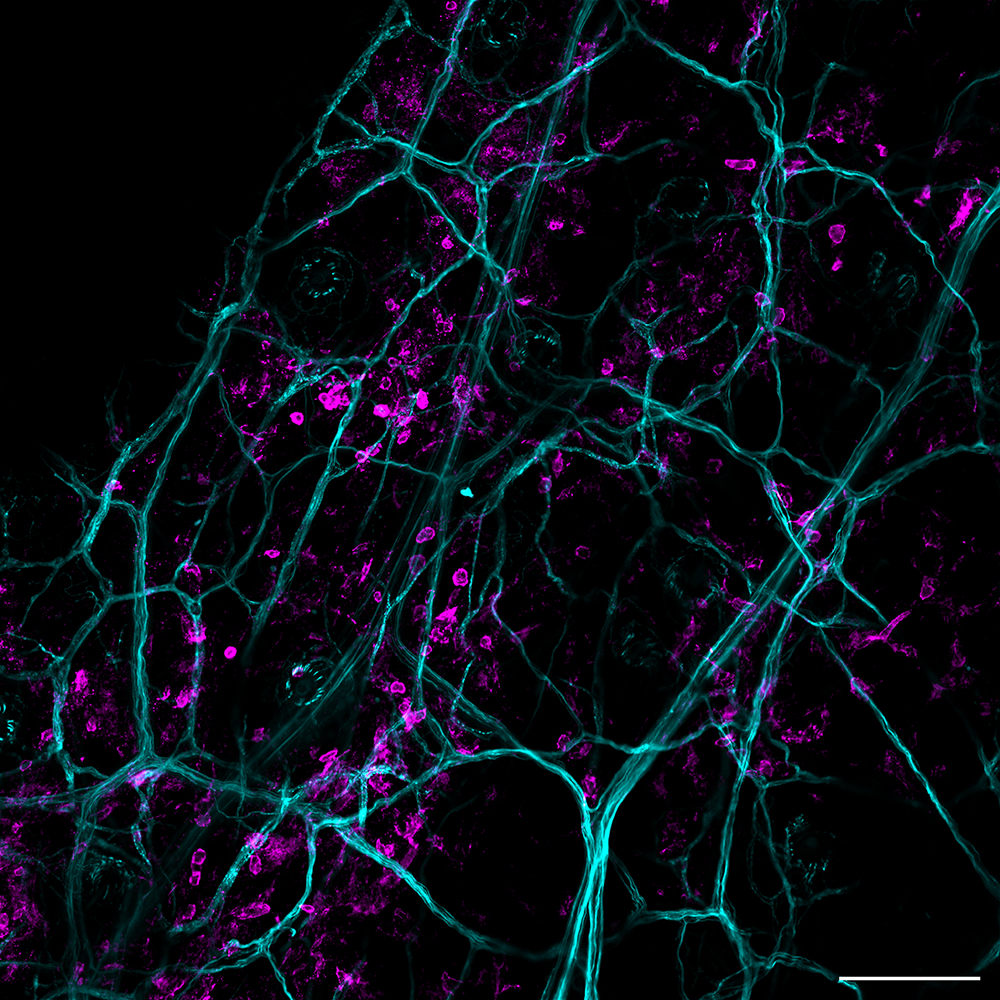  100 µm.