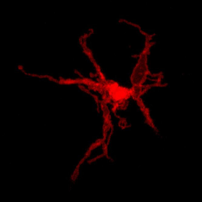 © Mai Nguyen Chi / macrophage visualisé grâce à la fluorescence rouge