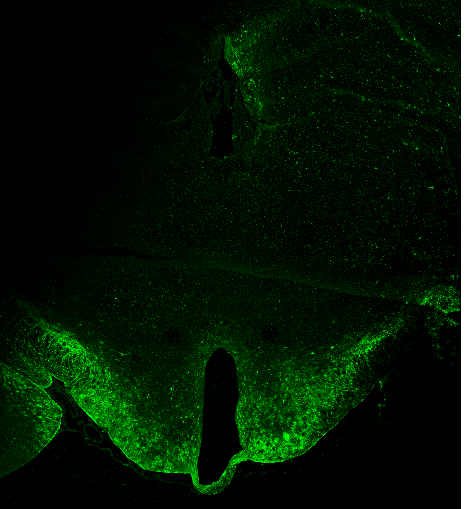 Injection des AAV9-shTERT permettant d'éteindre l'expression de Tert dans l'hypothalamus