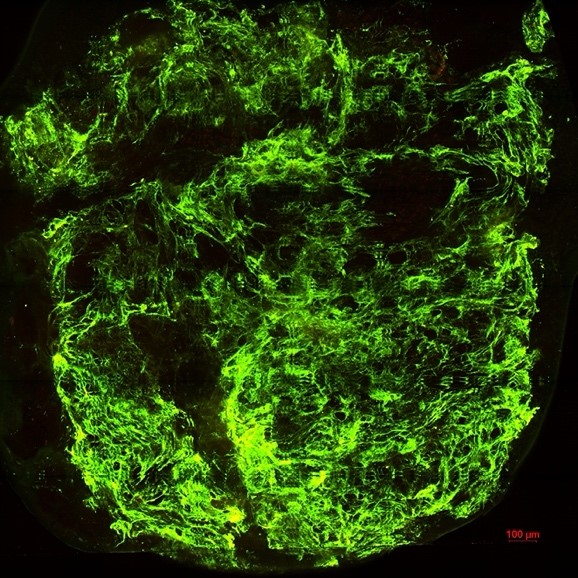 Nano-particules fluorescentes (vert) piégées dans le réseau de mucus intestinal. © LRP / TIMC / Dácil Idaira Yánez Martín