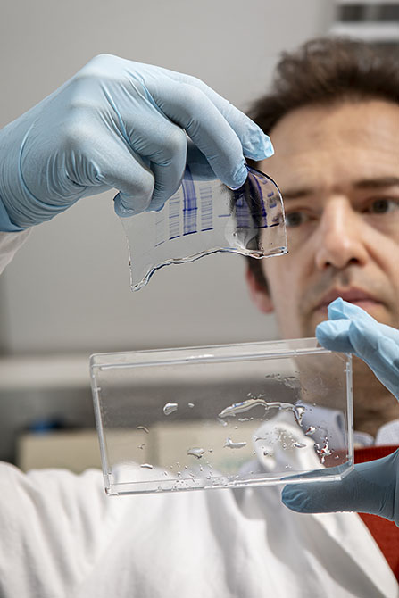 Contrôle qualité des protéines par électrophorèse.