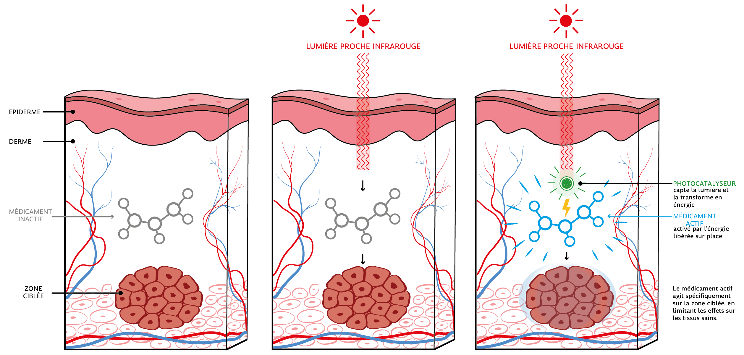 Effets de la lumière proche-infrarouge et d'un photocatalyseur © Catherine Berger Les lumières ultraviolettes, bleues et visibles ne pénètrent pas ou en très faible profondeur les tissus biologiques. La lumière proche-infrarouge est quant-à-elle en mesure de traverser environ un centimètre de tissu, mais son énergie n’est pas suffisante pour déclencher une réaction chimique qui activerait une molécule d’intérêt. La présence d’un photocatalyseur permet la transformation d’énergie lumineuse en énergie chimique. Cette énergie peut alors être transférée à la molécule que l’on souhaite faire