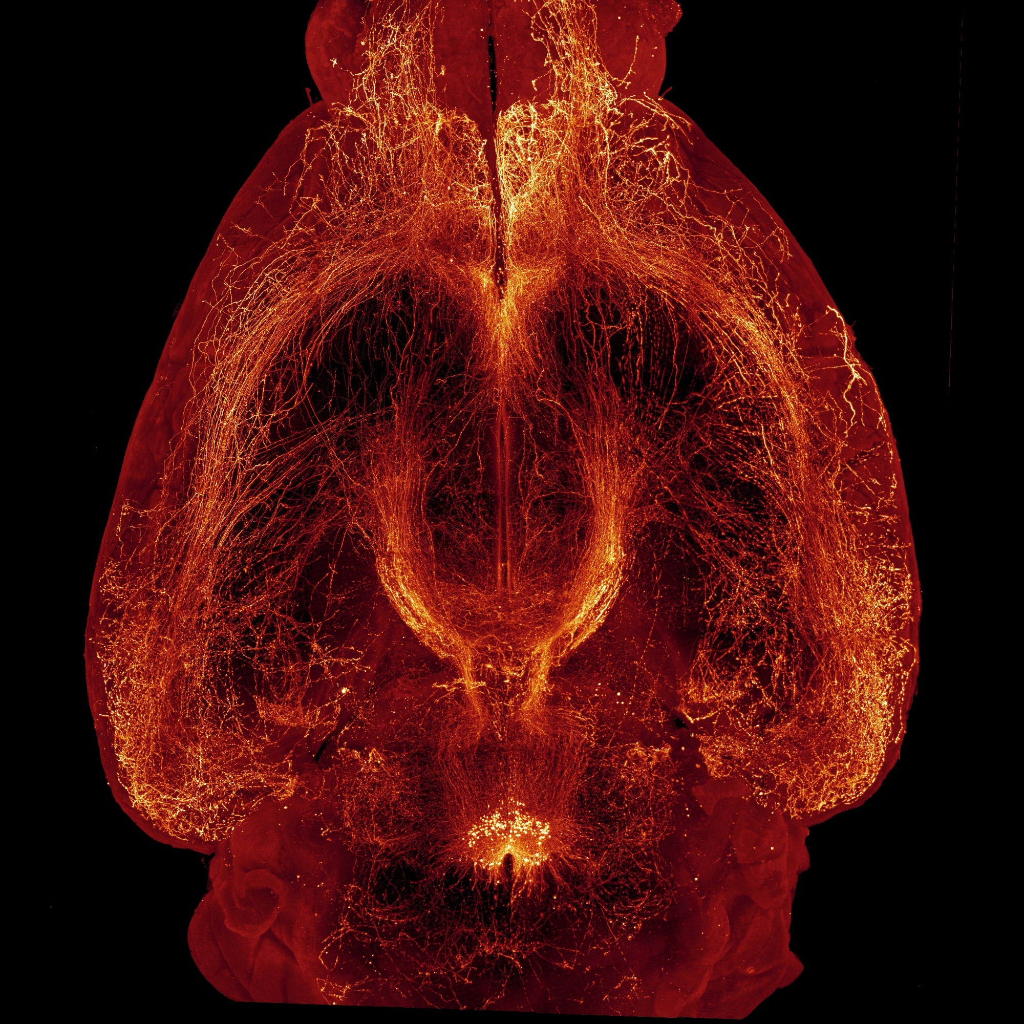 Visualisation des fibres nerveuses contenant de la relaxine-3 après transparisation du cerveau entier d'une souris.
