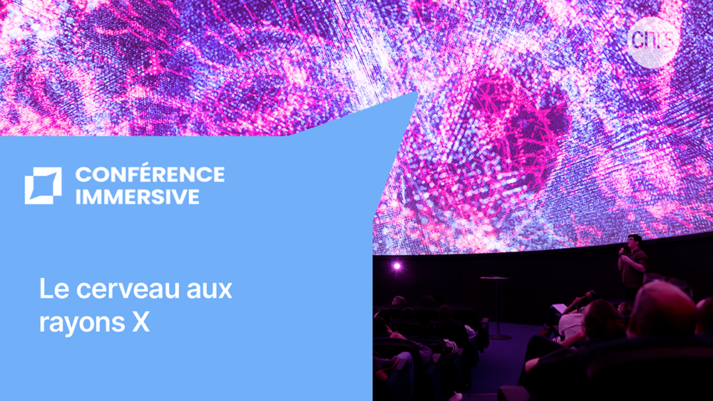 Conférence immersive Le cerveau aux rayons X 