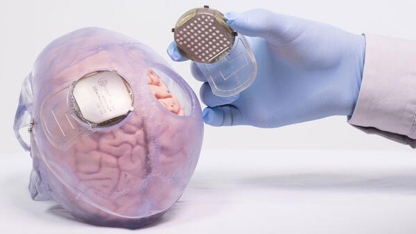 Implant Wimagine par Clinatec