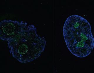 Comparaison de cellules dans le traitement de la Progeria