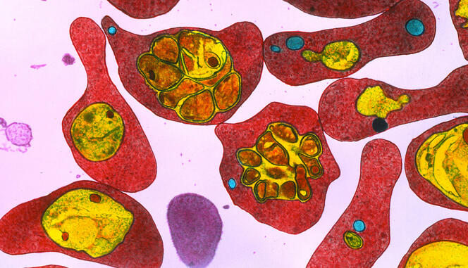 ©Science Photo Library / Murti, Dr. Gopal