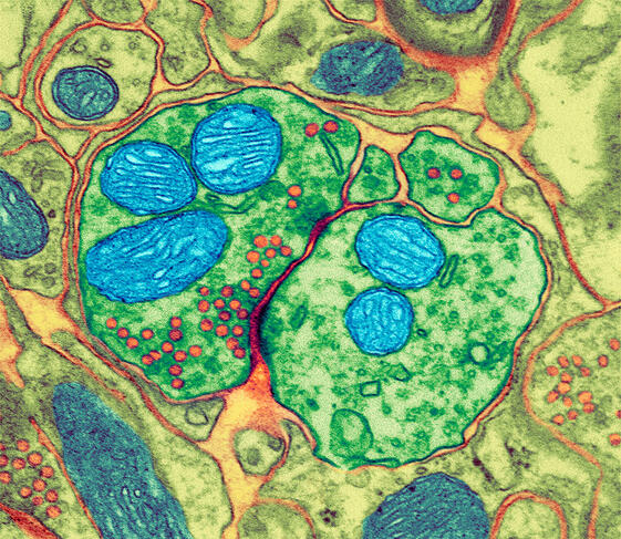 synapse en coupe au microscope électronique © Thomas Deerinck, NCMIR / Science Photo Library