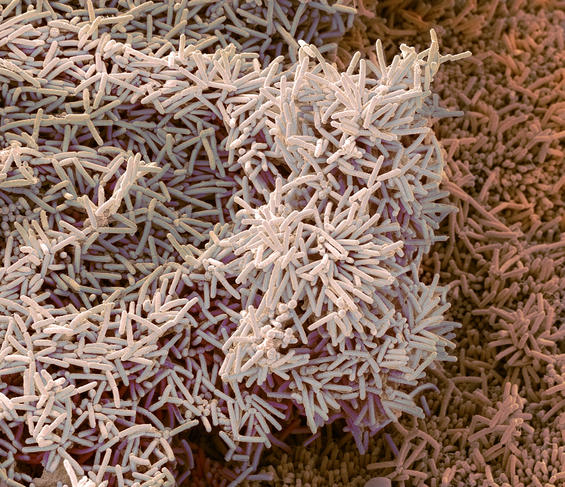 ©Science Photo Library / Gschmeissner, Steve