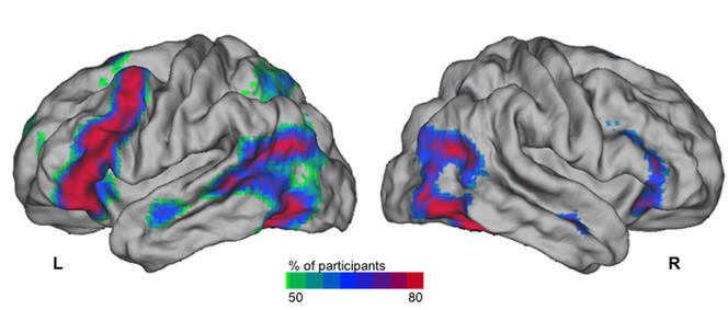 Carte des régions cérébrales activées en IRM fonctionnelle