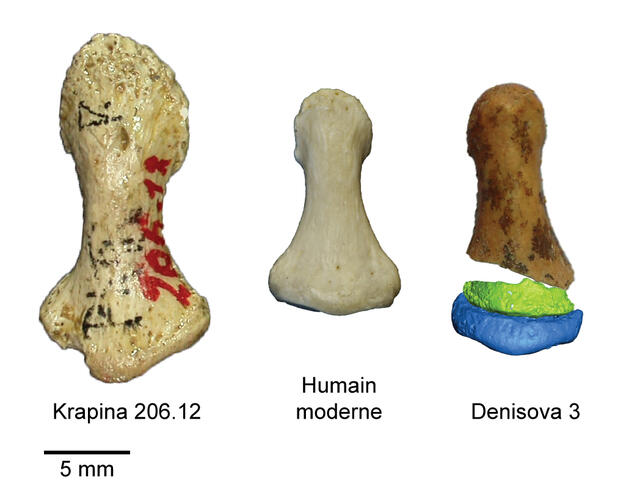 ©Croatian Natural History Museum collections, Zagreb, Croatie ; © I. Crevecœur, UMR 5199 PACEA, Université de Bordeaux ; © E.-M. Geigl, IJM, CNRS, Université de Paris ; virtual reconstruction © Ben Viola Department of Anthropology, Trois phalanges comparées : celles d’un Néandertalien (à gauche), d’un humain moderne (au centre) et d’une phalange partiellement reconstruite de Dénisovien.