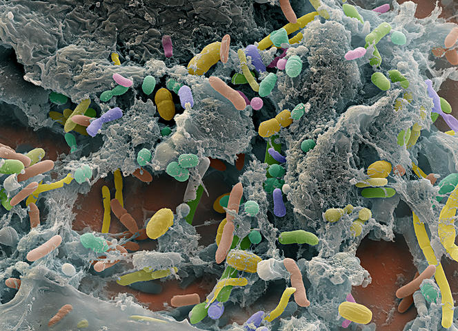 ©Eye of Science / Science Photo Library