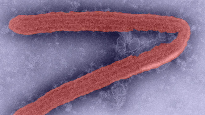 ©source CDC / Fred A. Murphy Virus Marburg au microscope électronique