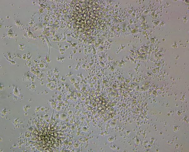 Vue au microscope de cellules dendritiques plasmacytoïdes (pDC) 