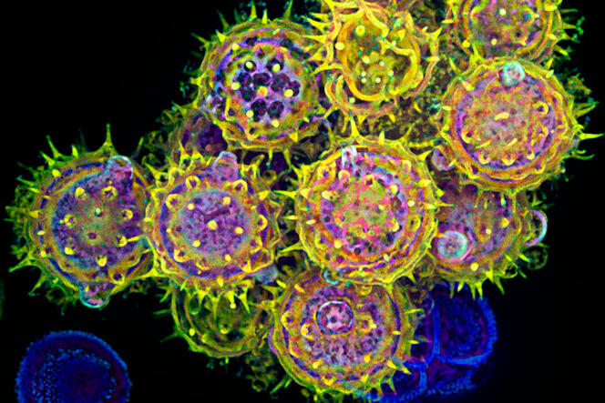 ©NIH / Edna, Gil and Amit Cukierman, Fox Chase Cancer Center, Philadelphia, PA grains de pollen vus au microscope et colorisés © NIH / Edna, Gil and Amit Cukierman, Fox Chase Cancer Center, Philadelphia, PA
