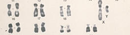 Caryotype humain mâle © CNRS Images