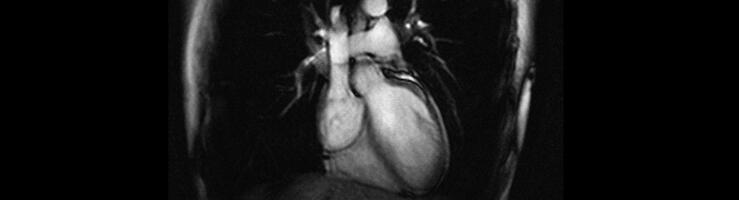 IRM cinétique du cœur humain © Université Paris-Sud / IR4M / CNRS Images