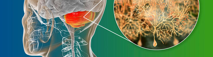 illustration localisant le cervelet et les cellules de Purkinje © Dr Microbe/iStock.com