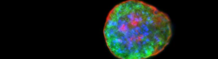Kyste isolé à partir de cerveau de souris, contenant des formes bradyzoïtes de Toxoplasma gondii. Les parasites sont en vert, leur noyau est coloré en bleu et la paroi du kyste en rouge. © Sébastien Besteiro