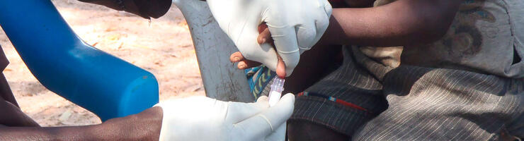 Prélèvement d'échantillons par piqûre au doigt pour le diagnostic de P. falciparum dans les zones rurales de Gambie © Antoine Claessens