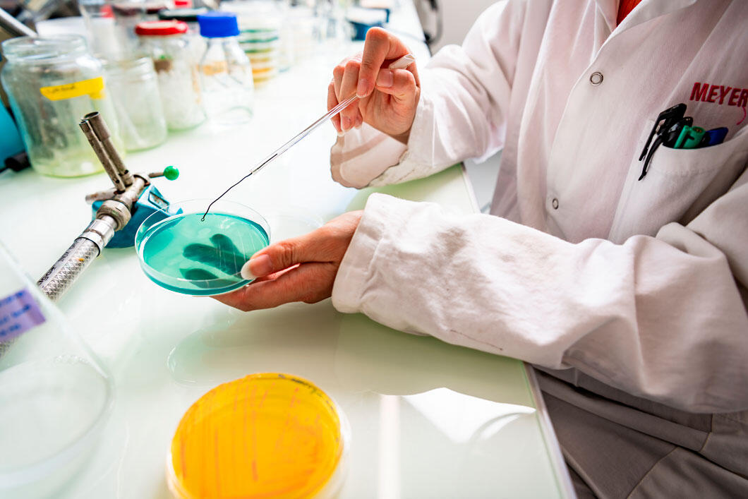 Deux boîtes de Petri, une jaune posée et une verte tenue par des mains. Le vert indique la dégradation de composés fluorés, et donc leur présence.