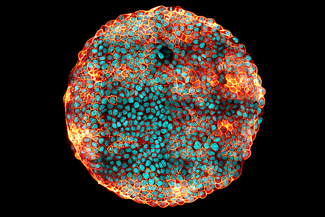 ©Nicolas Harmand, David Pereira, Sylvie Hénon, Laboratoire Matière et Systèmes complexes (CNRS / Université Paris Diderot), 2017