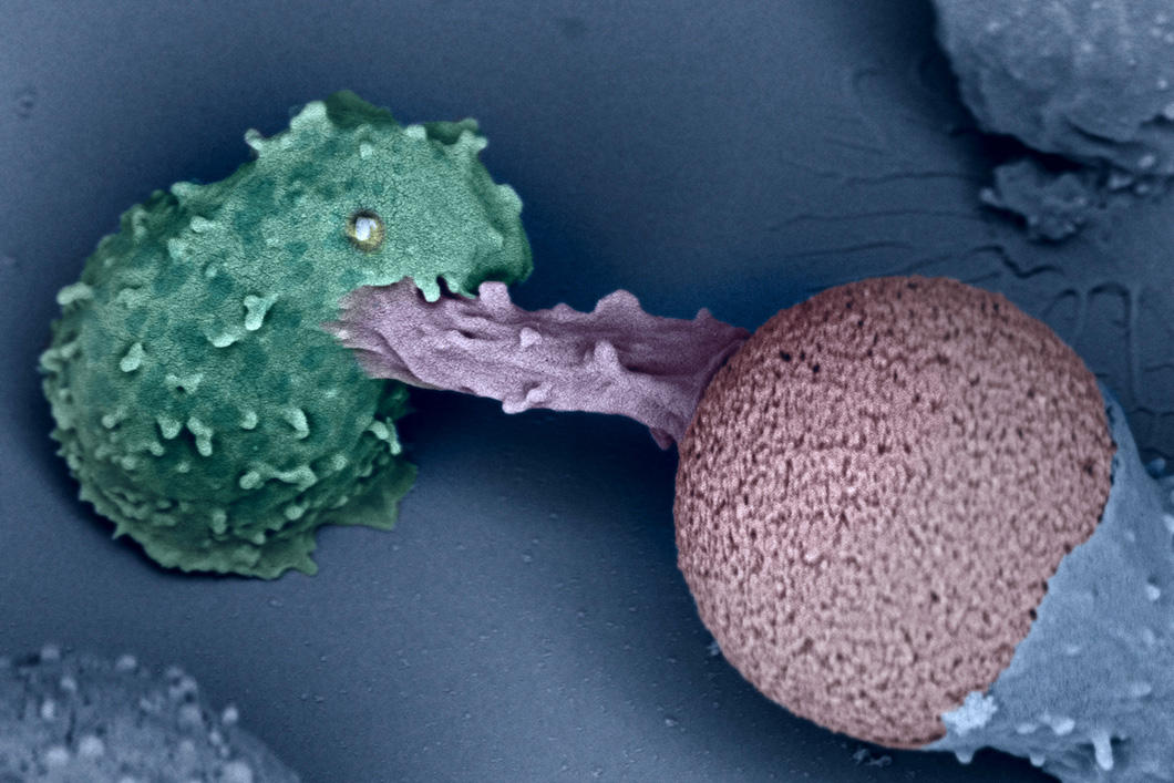 ©Virginie Bazin IPBS / Université Pierre et Marie Curie, Claire Hivroz, Julien Husson / CNRS / Ecole polytechnique / Inserm / Institut Curie, 2016