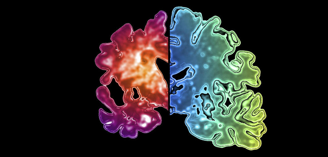 ©PASIEKA/Science Photo Library/Corbis