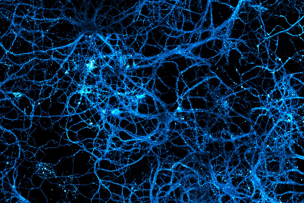 Du neurone à la pensée Neurone_4