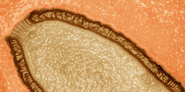 Le virus géant "Pithovirus sibericum"