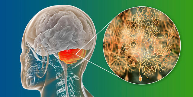 Illustration localisant le cervelet et les cellules de Purkinje © Dr_Microbe/iStock