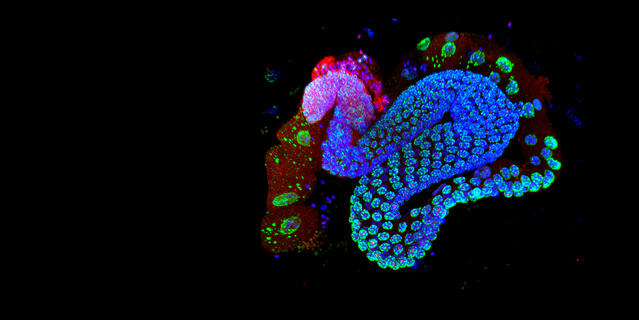 Appareil reproducteur du ver Caenorhabditis elegans vu en microscopie confocale à fluorescence.