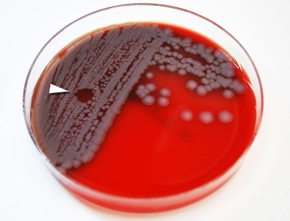 Image CDC / Megan Mathias and J. Todd Parker