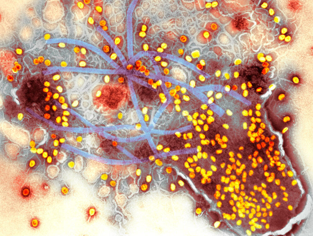 Lyse ou explosion © Dept. of Microbiology, Biozentrum / R.Bijlenga / SPL