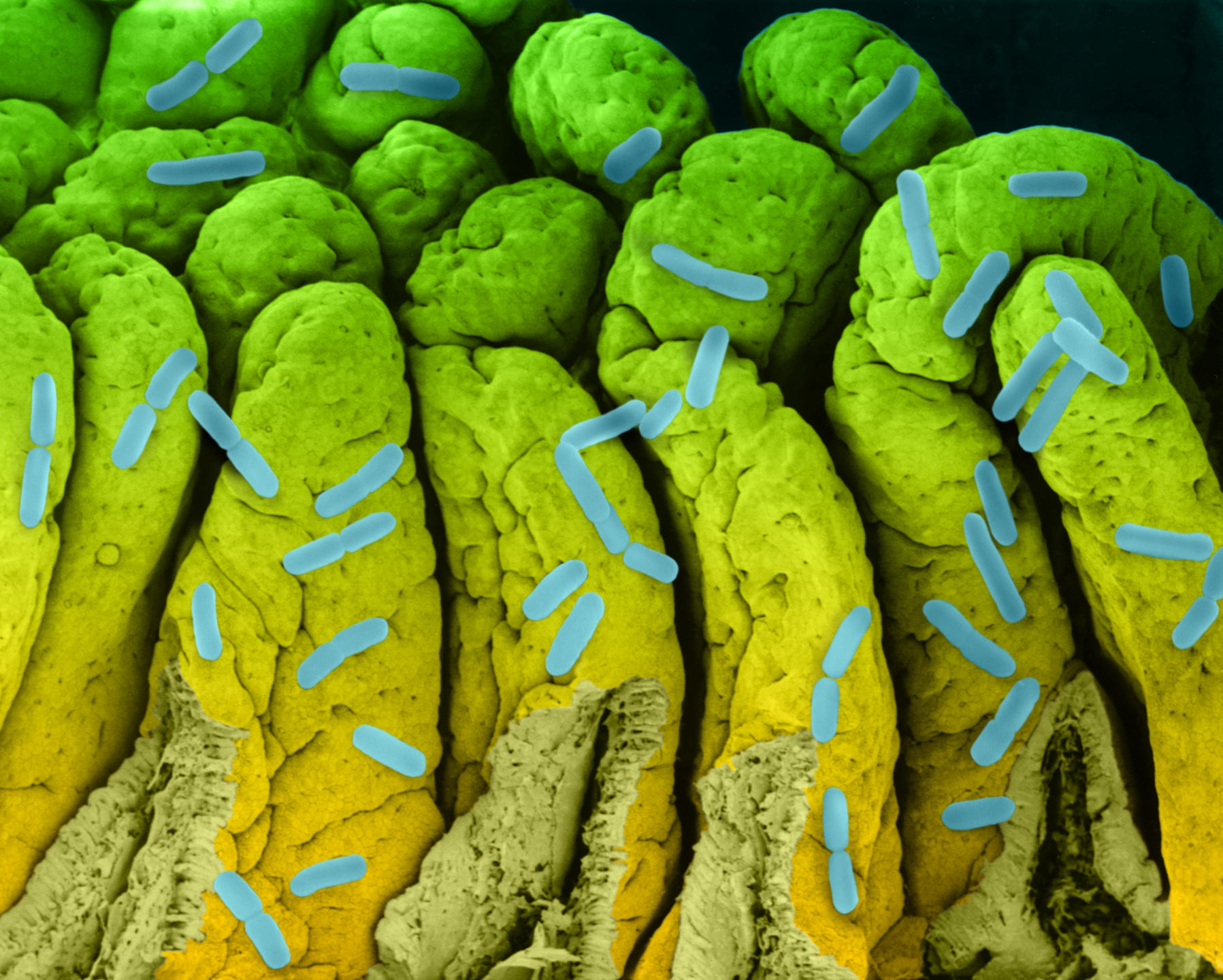 Bactérie e-coli