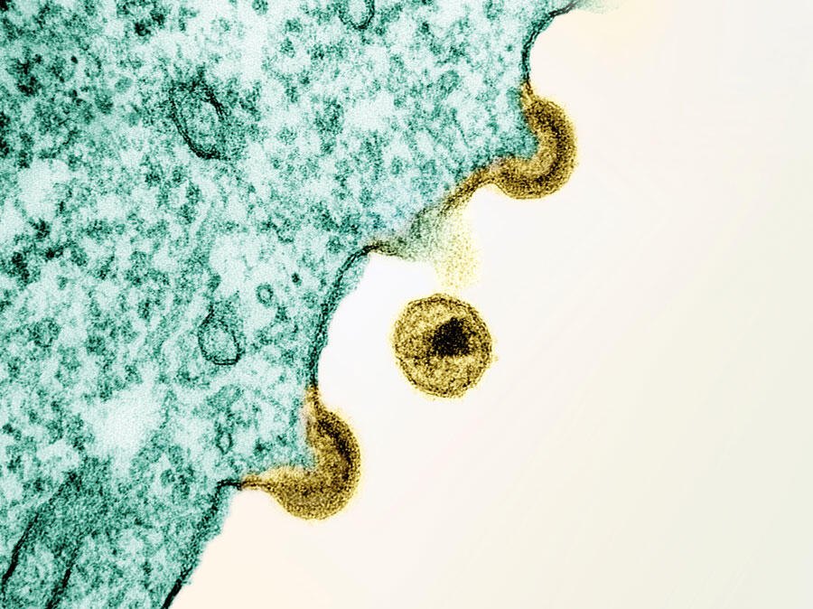 Image de microscopie électronique colorisée montrant le bourgeonnement du virus à la surface d’une cellule souche. Un virion est visible à l'extérieur de la cellule. 
