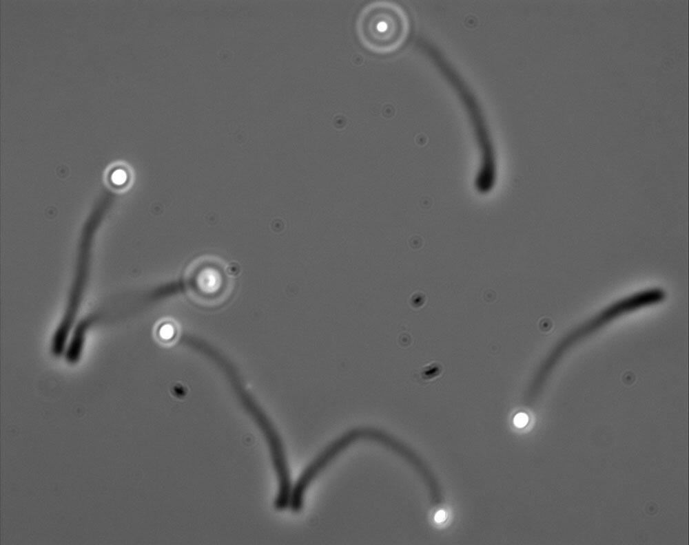 billes et protéine WASP