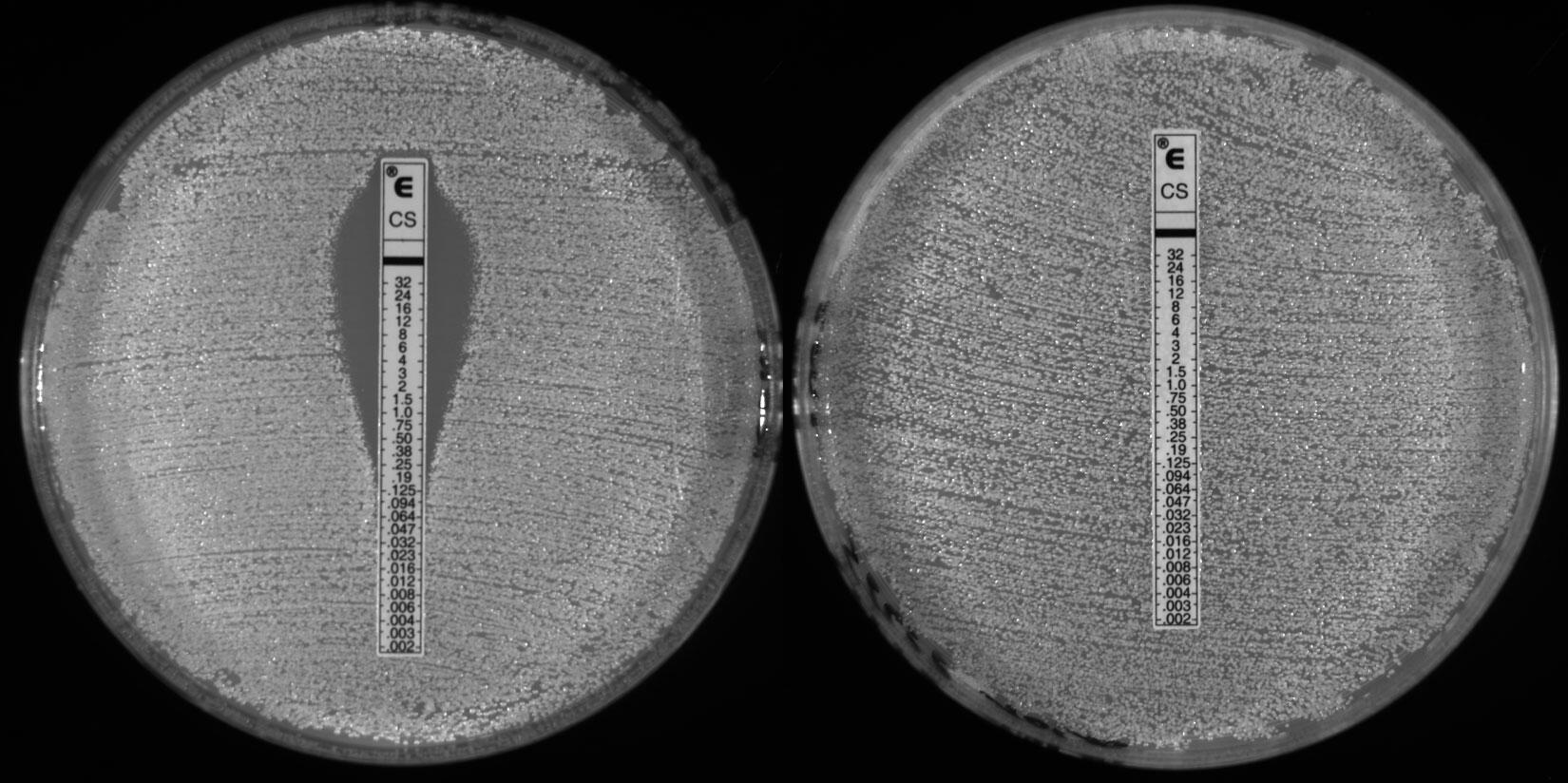 ©Maxime Lefranc, MFP, équipe Candida et pathogénicité. Antifongigramme © Maxime Lefranc, MFP, équipe Candida et pathogénicité