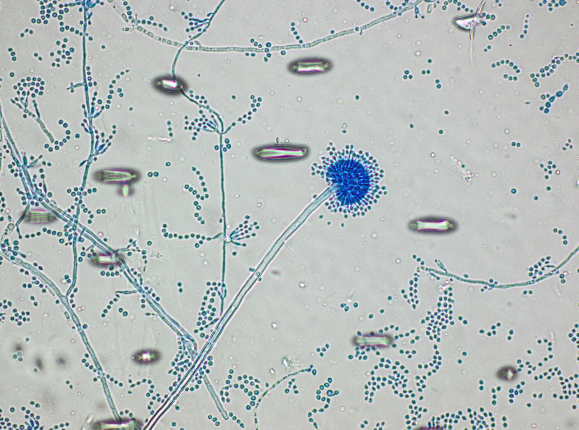 Споры гриба и нити. Грибы кандида микроскопия. Аспергилл кандида. Конидии аспергилла. Микроскопия аспергилл.